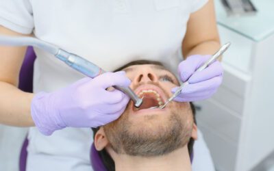 Fissure Sealants