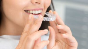 Invisalign