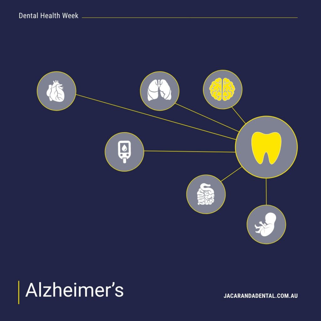 Alzheimer's Disease 
